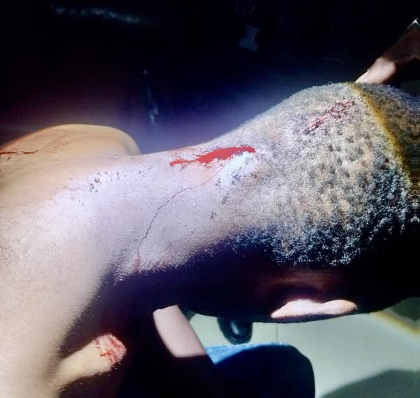 Hijacking Victim Stabbed: Waterloo - KZN